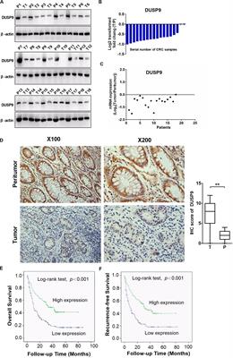 Downregulation of DUSP9 Promotes Tumor Progression and Contributes to Poor Prognosis in Human Colorectal Cancer